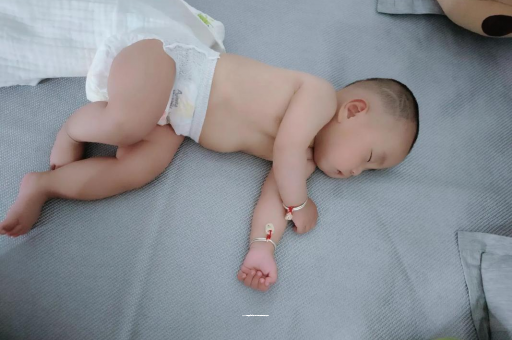 红河宝宝头上长痱子